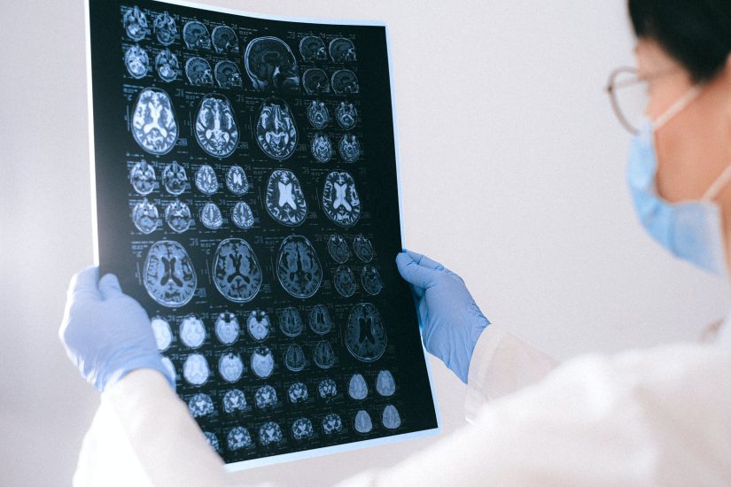 Neurologist reviews brain scans for signs of traumatic brain injuries.